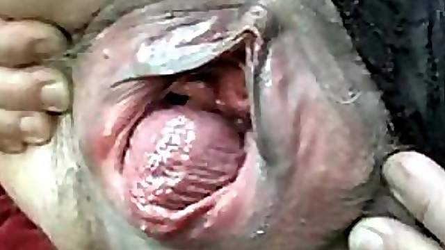 Close Up Video of a Mature Lady's Prolapsing Pussy