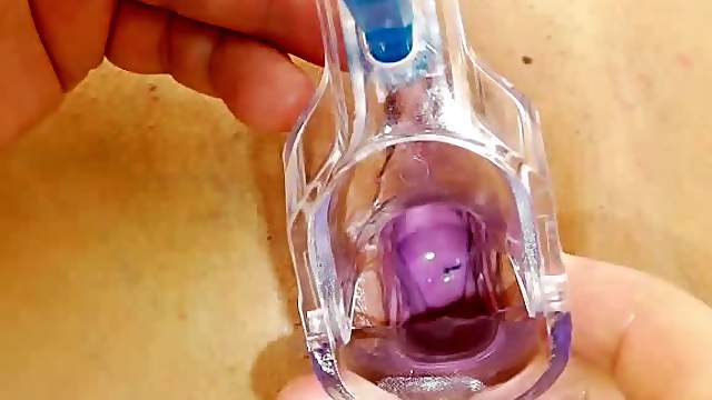 Matured gyno in addition to a super smoking-hot brunette