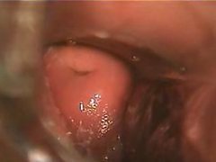 Delicious Brunette's Close Up Shot Of Her Wet Pussy With a Speculum